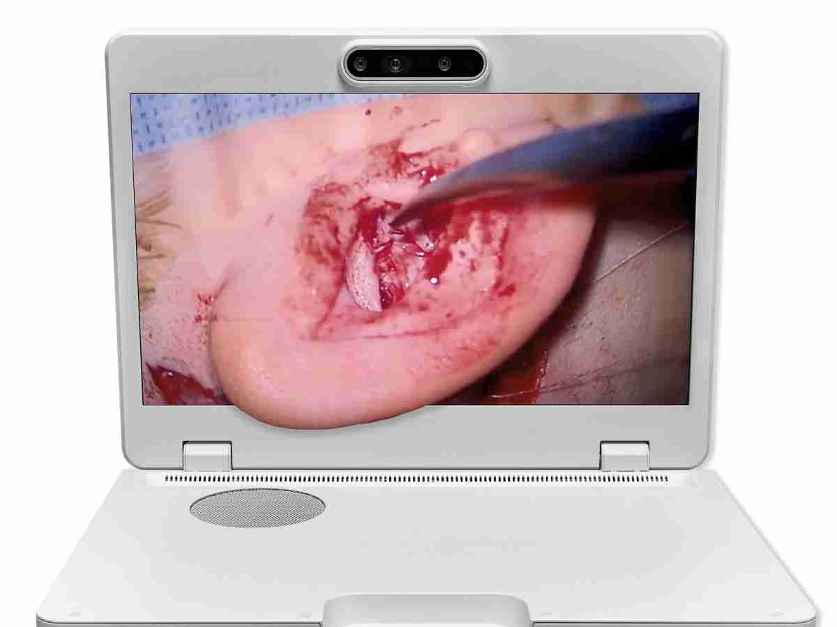 达擎之＂Heads-up 3D显微手术显示系统＂，，，整合4K裸眼3D显示及眼球追踪系统，，，，具备快速追踪人眼移动位置功能，，，，减轻医师长时间维持固定姿势的负担，，，让医师能有更宽广清晰的3D立体视野及更舒适的姿势来执行手术。。。